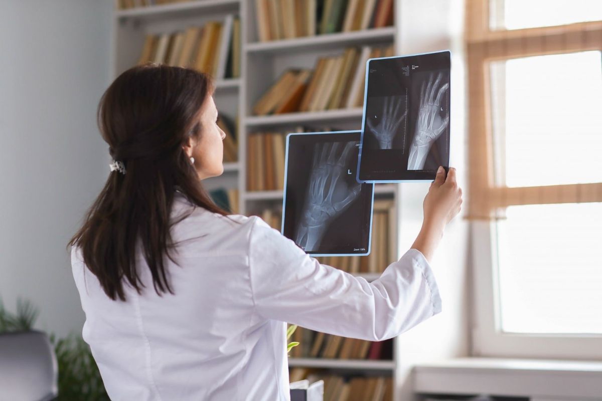 Osteoporosis: ¿Qué es?, ¿cómo detectarla? y ¿cómo prevenirla?