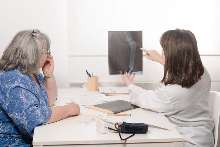 ¿Qué es la osteoporosis y cómo afecta a tus huesos?